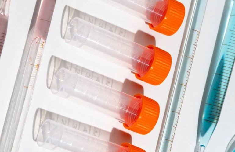 Malzeme Markamız Güncellendi